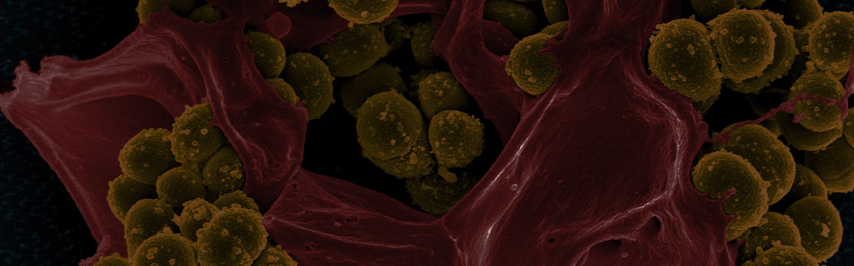 Antimicrobial resistant bacteria Methicillin-resistant Staphylococcus aureus