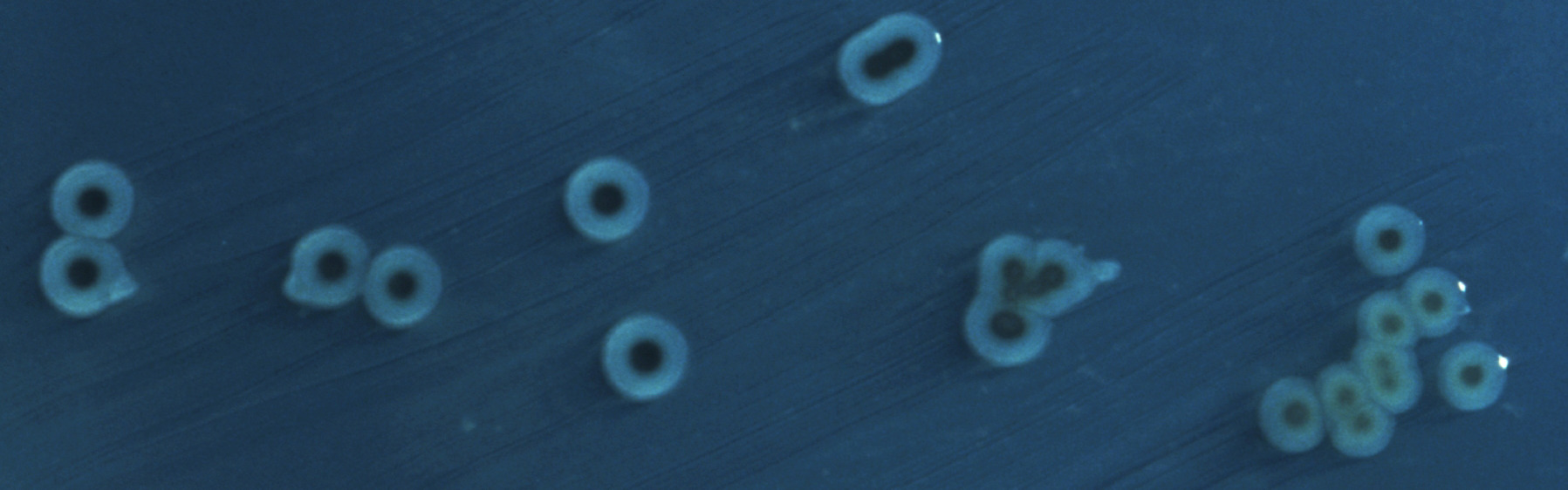 Colonies of pathogenic bacteria growing on an agar culture plate - Salmonella enterica