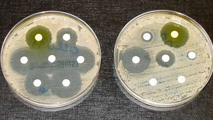 Petri dishes with microbes