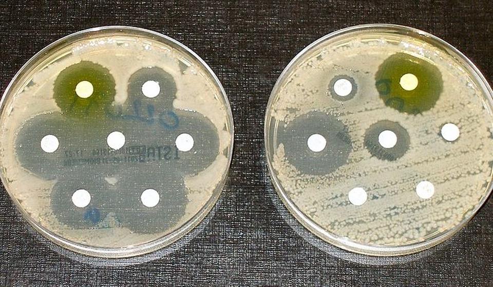 Petri dishes with microbes